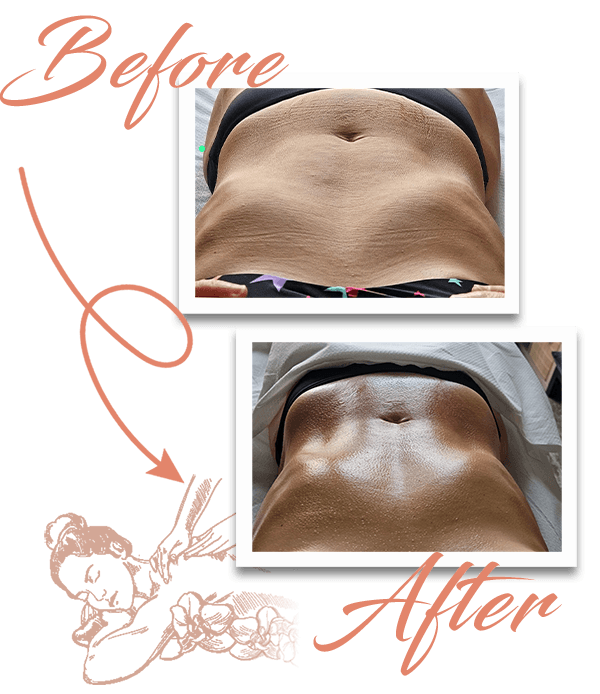 Massaggio linfodrenante a Domodossola Metodo Manuela Shala